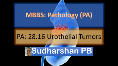PA 28.16 Urothelial Tumors