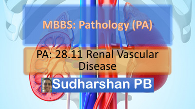 PA 28.11 _ Renal vascular disease