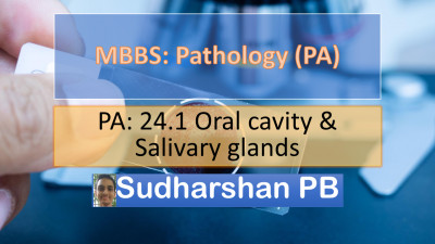PA 24.1 Oral cavity & Salivary gands