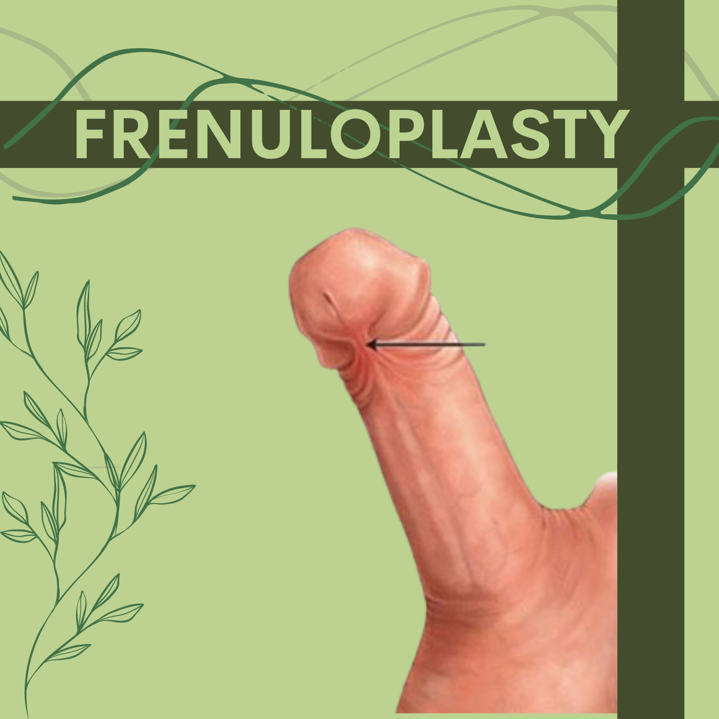 Penile Lengthening, Penis Enlargement Surgery, Male Enhancement, Surat, Gujarat, Mumbai, Pune. episode artwork