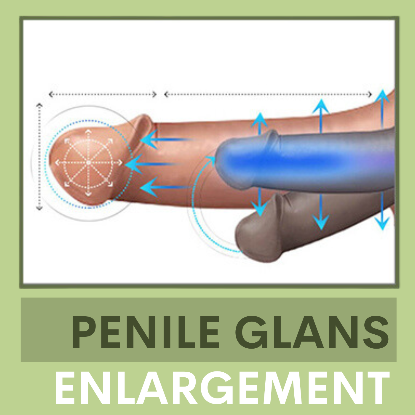 Penile Glans Enlargement, Penile Lengthening, Large Penile, Ahmadabad, Nasik, Pune, Mumbai, India episode artwork