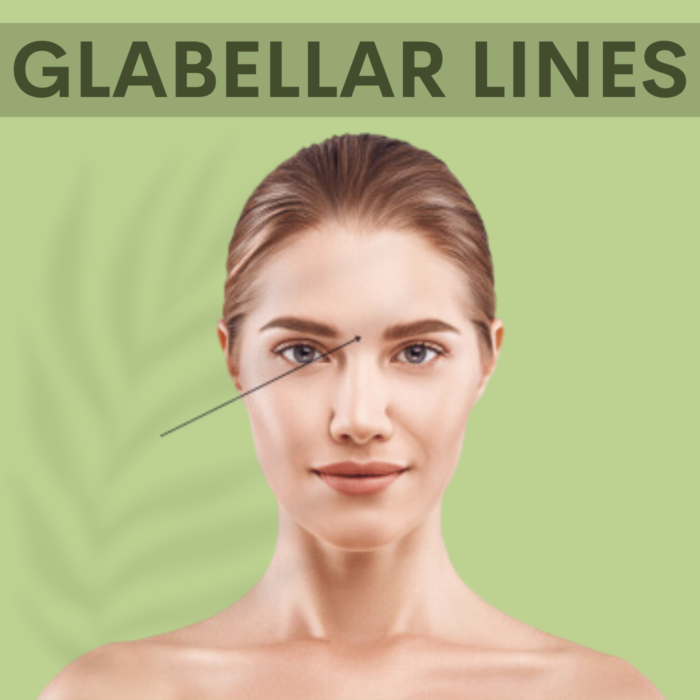 Glabellar Line, Botox - Filler Treatment Surat, Vadodara, Ahmedabad, Gujarat, Mumbai, Maharashtra episode artwork