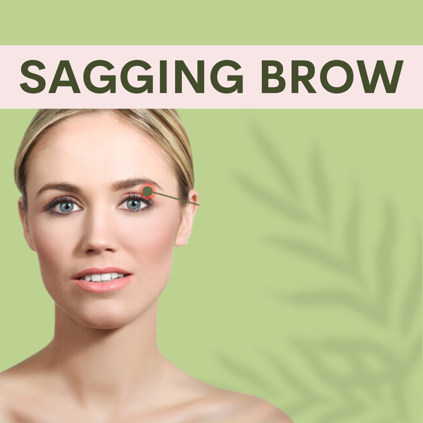 Sagging Brow, Botox and Filler Treatments Clinic Surat, Gujarat, Mumbai, Pune, Maharashtra episode artwork