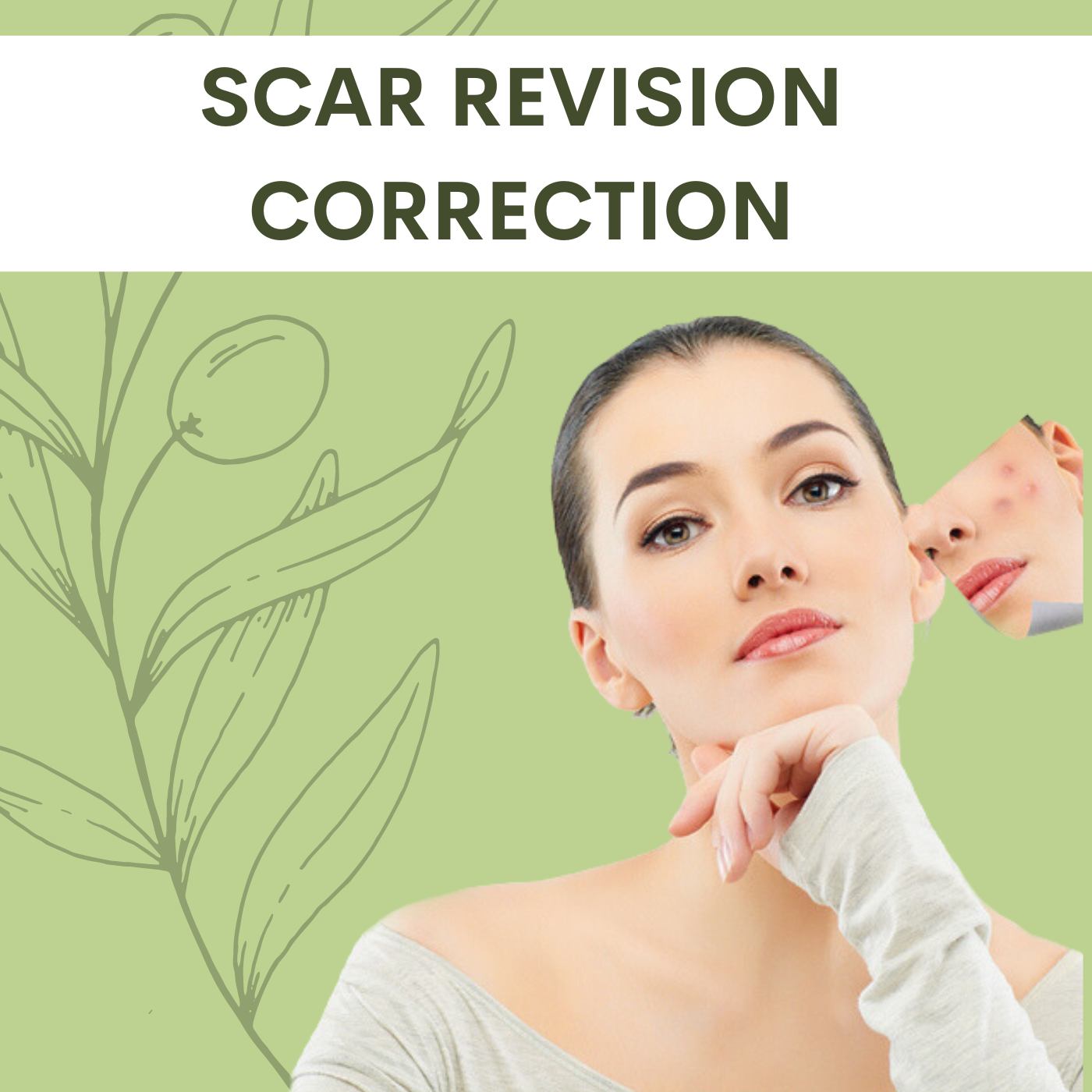 Scar Revision Correction, pal, adajan, vesu, piplod, athwagate,bhatar, olpad, elegance clinic episode artwork