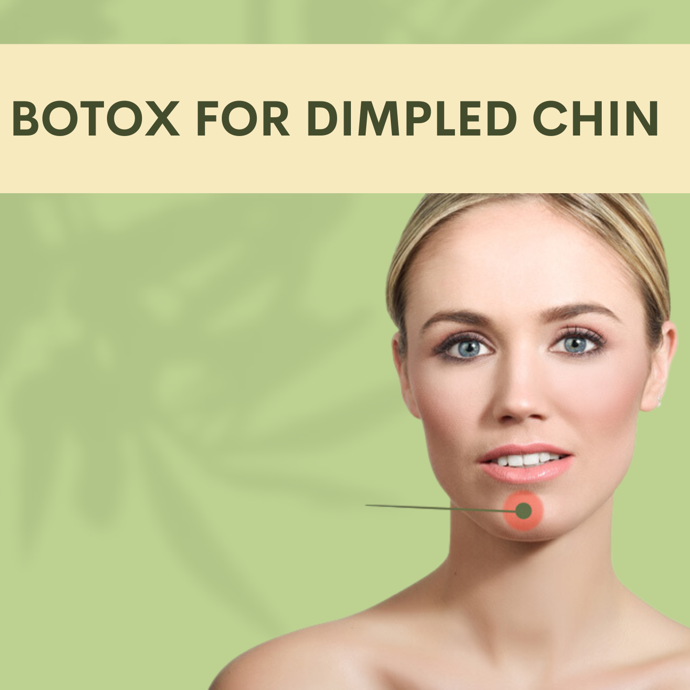 Botox for Dimpled Chin, injections to relax the muscle, pal, adajan, vesu, piplod, athwagate,bhatar, olpad, elegance clinic episode artwork