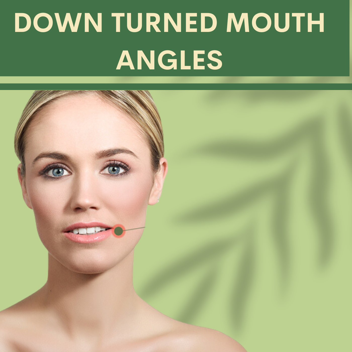 Down turned mouth angles, volume loss because of aging pal, adajan, vesu, piplod, athwagate,bhatar, olpad, elegance clinic episode artwork