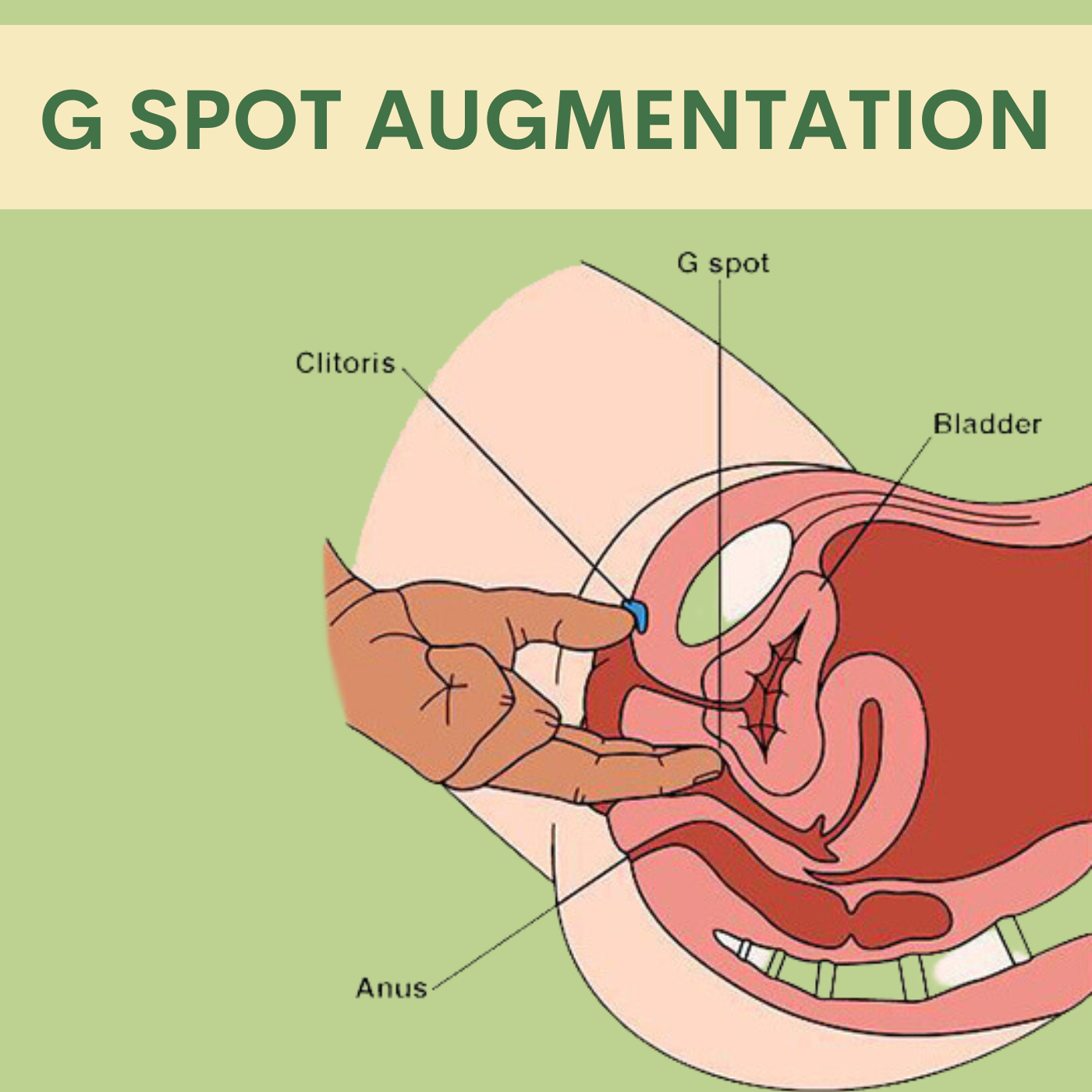 G spot augmentation enhancement, pal, adajan, vesu, piplod, athwagate,bhatar, olpad, elegance clinic episode artwork