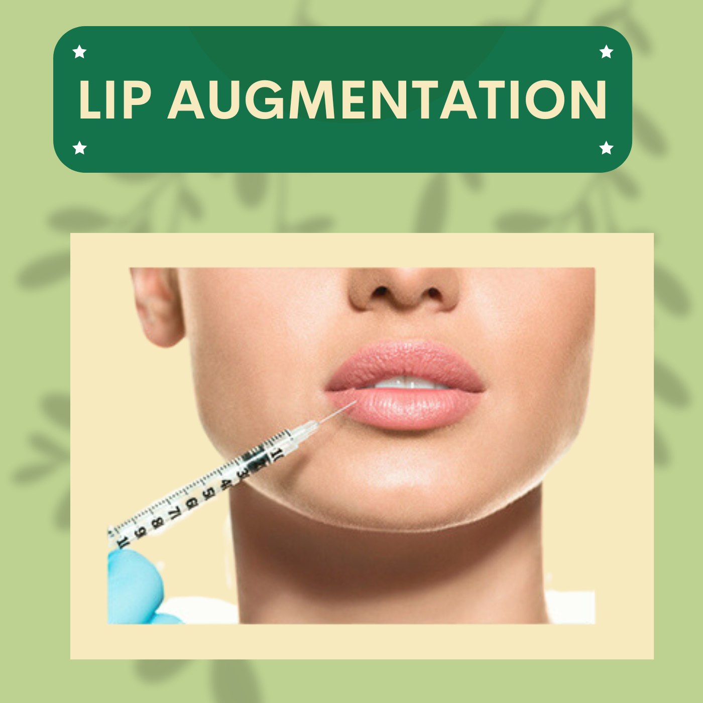 Lip augmentation, bigger and plumper pal, adajan, vesu, piplod, athwagate,bhatar, olpad, elegance clinic episode artwork