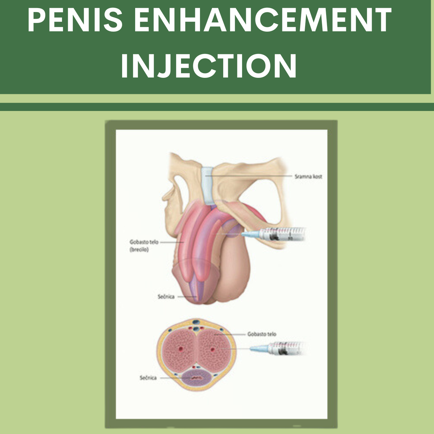 Penis Enhancement Injection, fillers, pal, adajan, vesu, piplod, athwagate,bhatar, olpad, elegance clinic