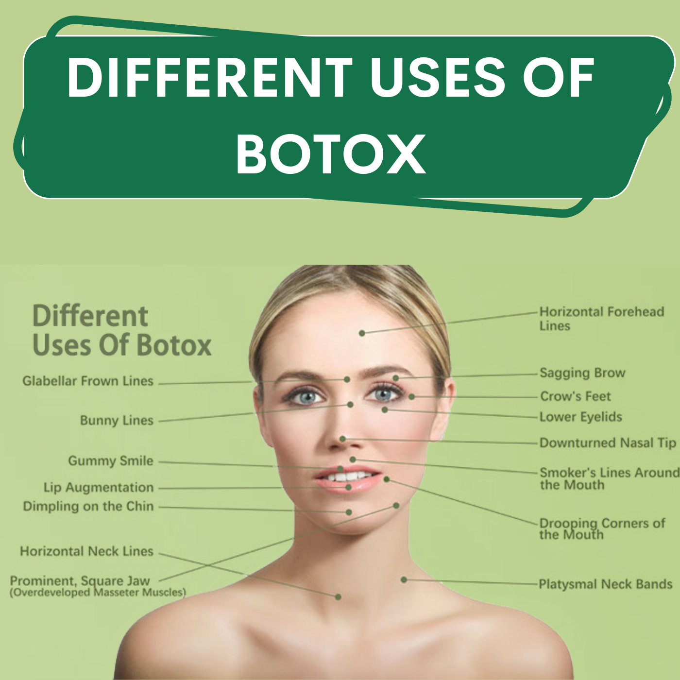 Different Uses Of Botox, antiageing treatment, wrinkles, pal, adajan, vesu, piplod, athwagate,bhatar, olpad, elegance clinic episode artwork