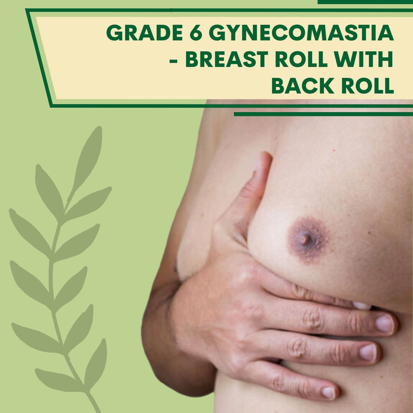 breast roll with back roll, lipo suction surgery, pal, adajan, vesu, piplod, athwagate,bhatar, olpad, elegance clinic episode artwork