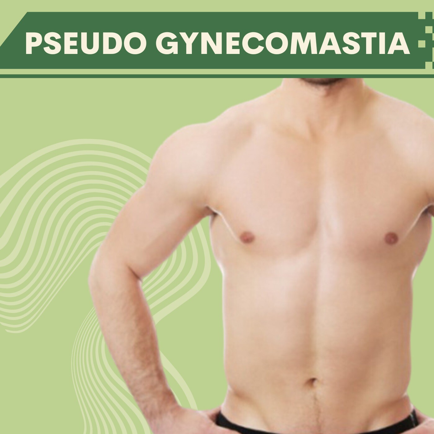 Pseudo Gynecomastia, Body Fat, Obese Patient, Nanpura, Athwa, Umra, Dindoli, Surat. episode artwork