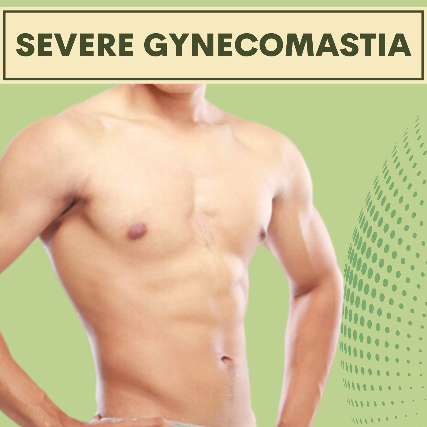 Severe Gynecomastia, For Weight Loss People, Big Size Glands, Gopipura, Athwa, Adajan, Pal, Surat. episode artwork