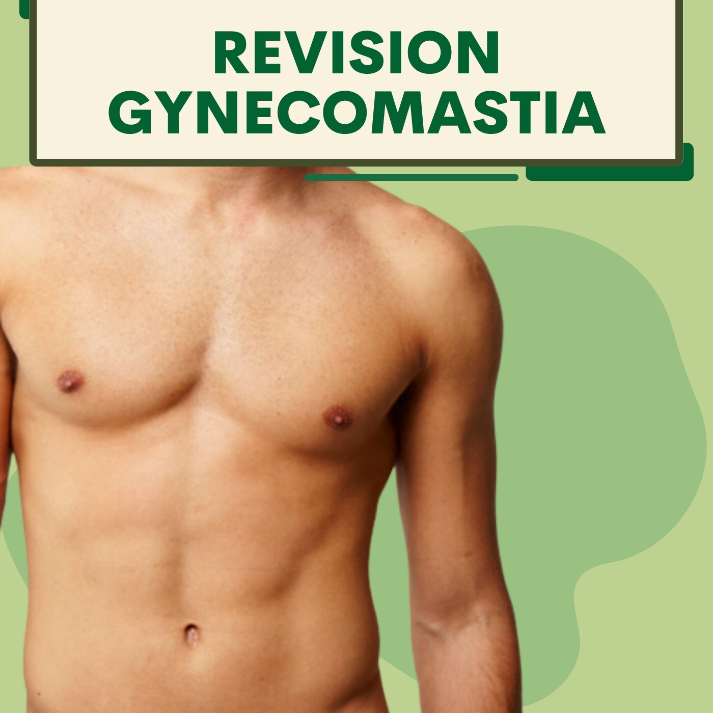 Revision Gynecomastia, Second Surgey, Carefully Removed Scars, Gopipura, Rander, Majura, Bhatar, Surat. episode artwork
