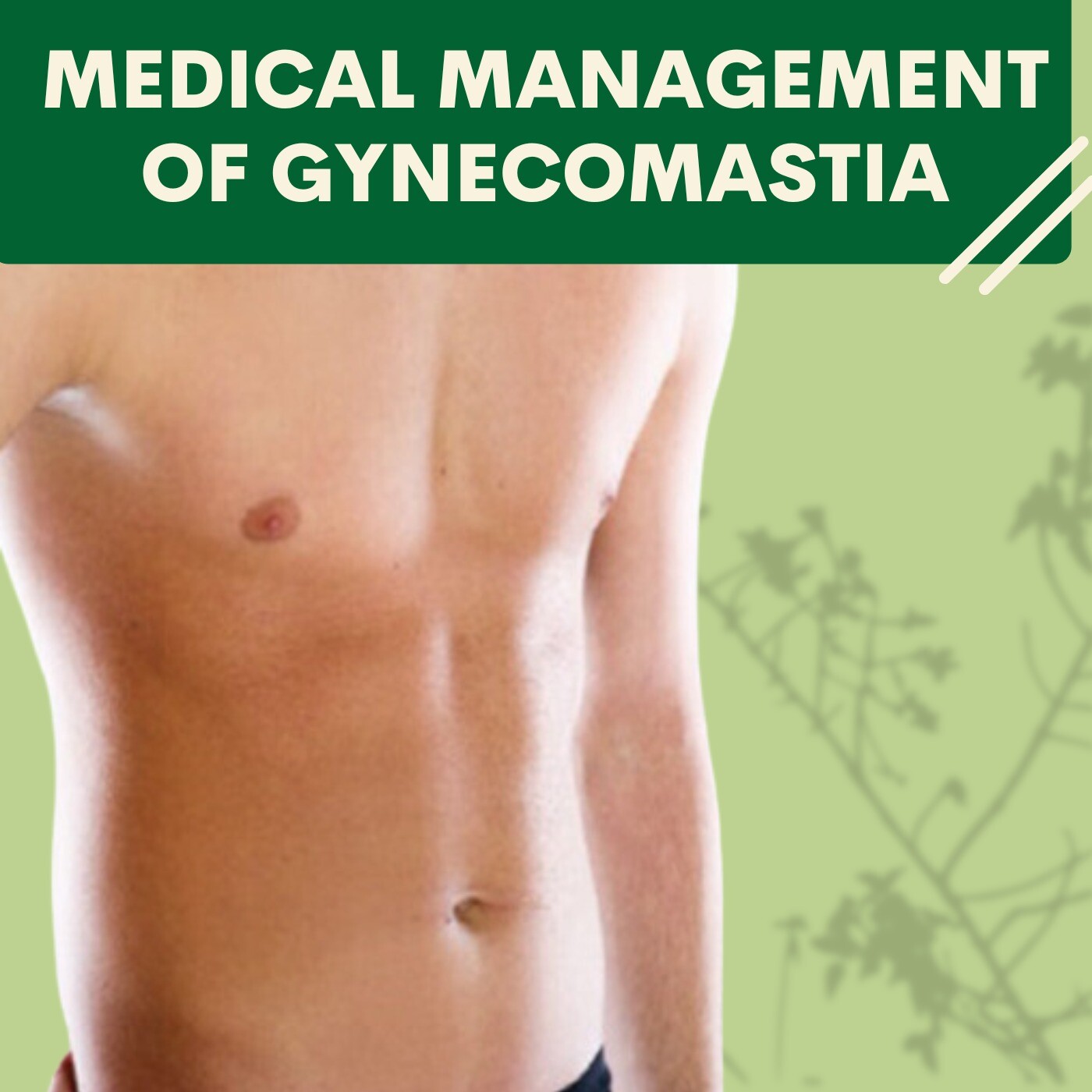 Medical Management Of Gynecomastia, Testerone Suppliment, Medicines, Dindoli, Rander, Majura, Udhna, Surat. episode artwork