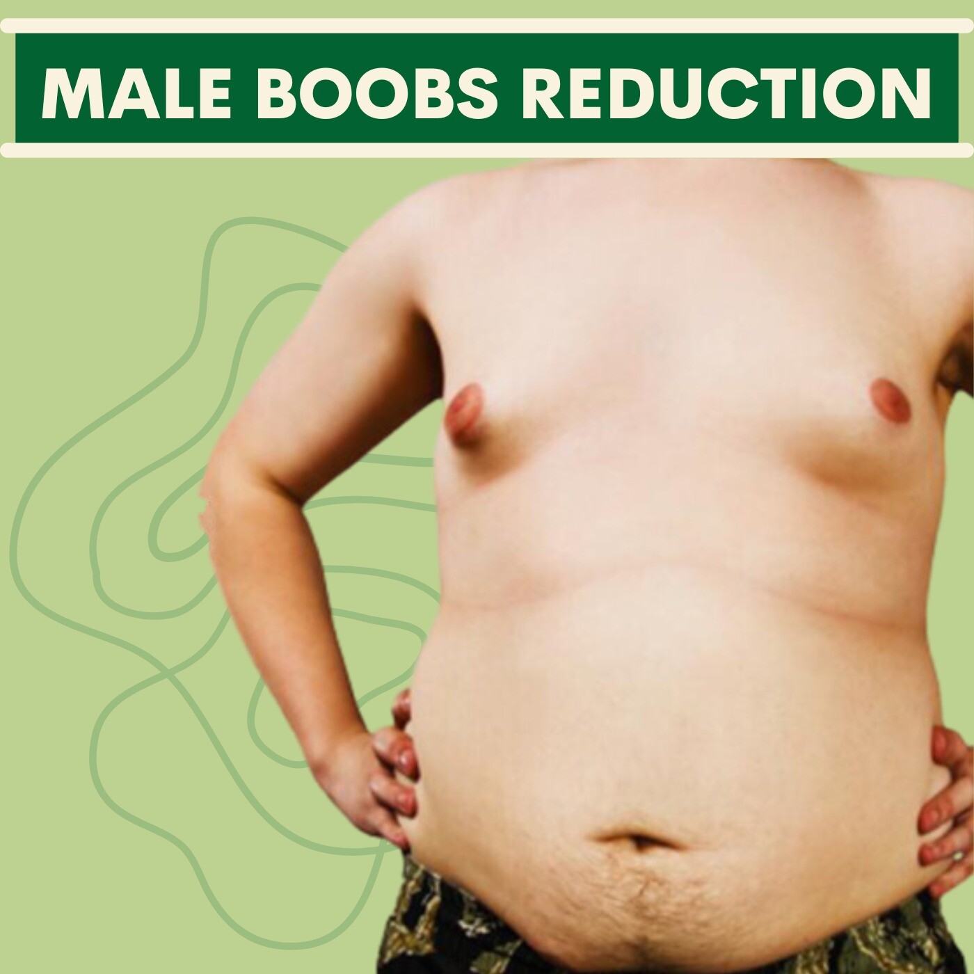 Male Boobs Reduction, Gland Excetion, Liposuction, Sarthana, Piplod, Udhna, Majura, Surat. episode artwork