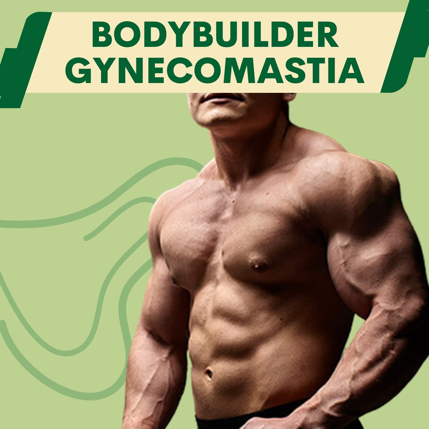 Body Builder Gynecomastia, Intake of steriods, Hormonal Balance, Udhna, Bhatar, Rander, Nanpura, Surat. episode artwork