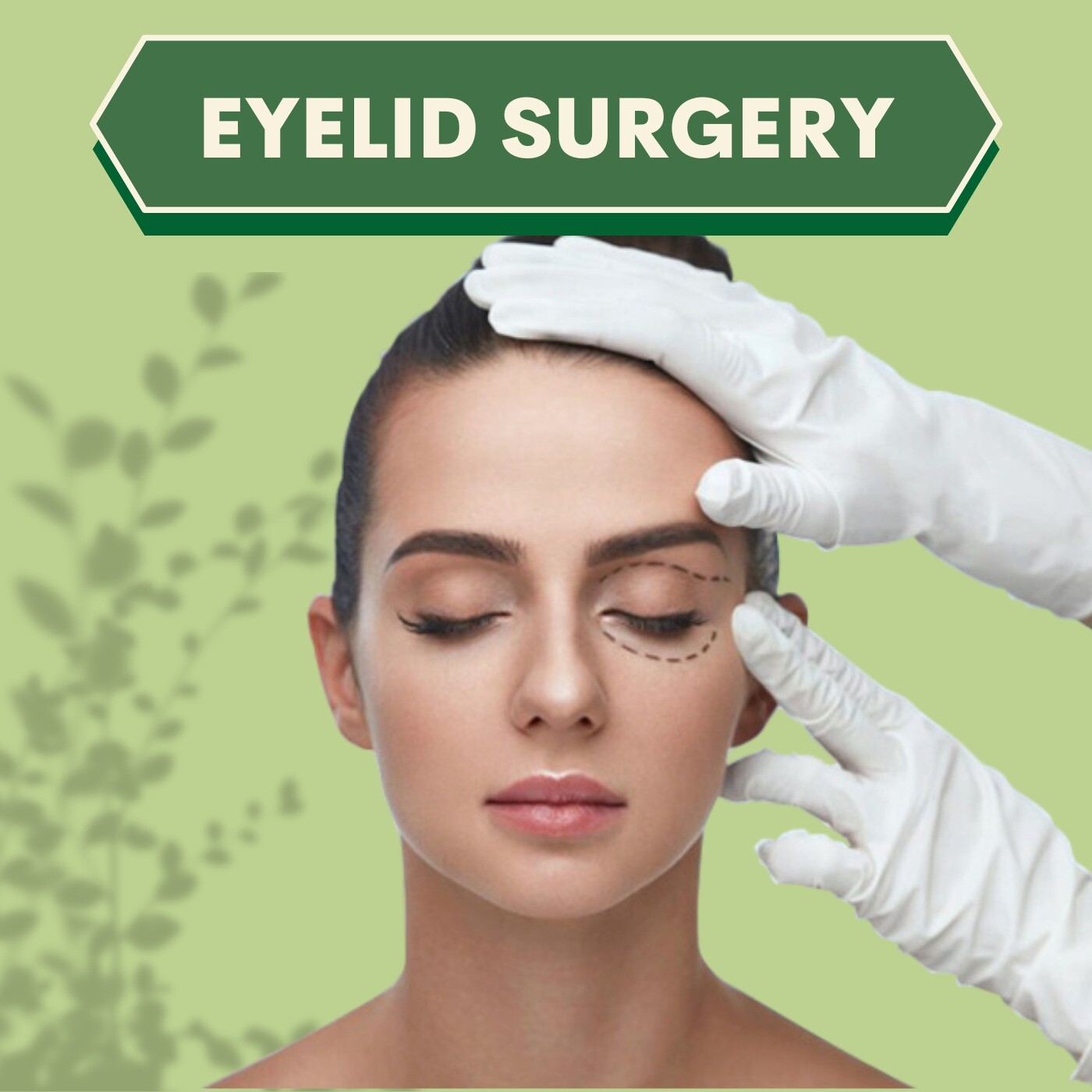 Eyelid surgery, antiaging, plastic surgery, umra, athwa, majura, piplod, surat, gujarat.
