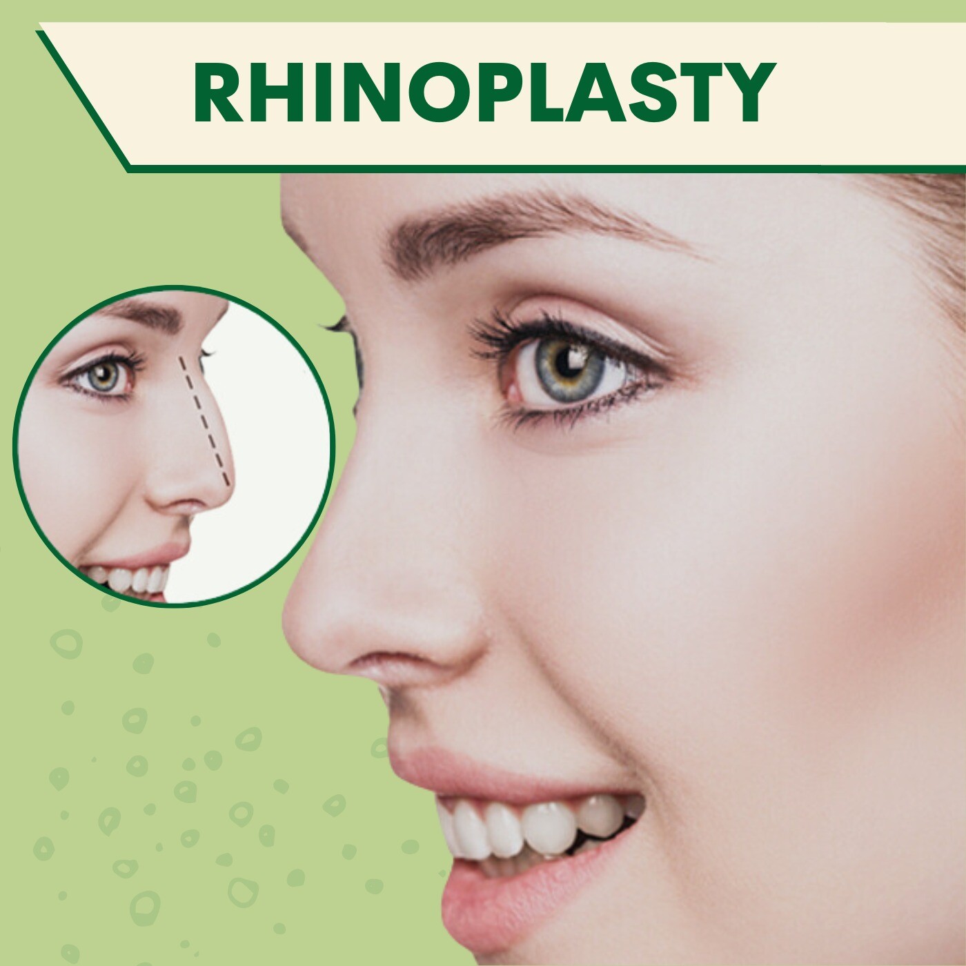 Rhinoplasty Surgery, Procedure For Shaping Nose, Bhatar, Pandesara, Valsad, Surat, Gujarat. episode artwork