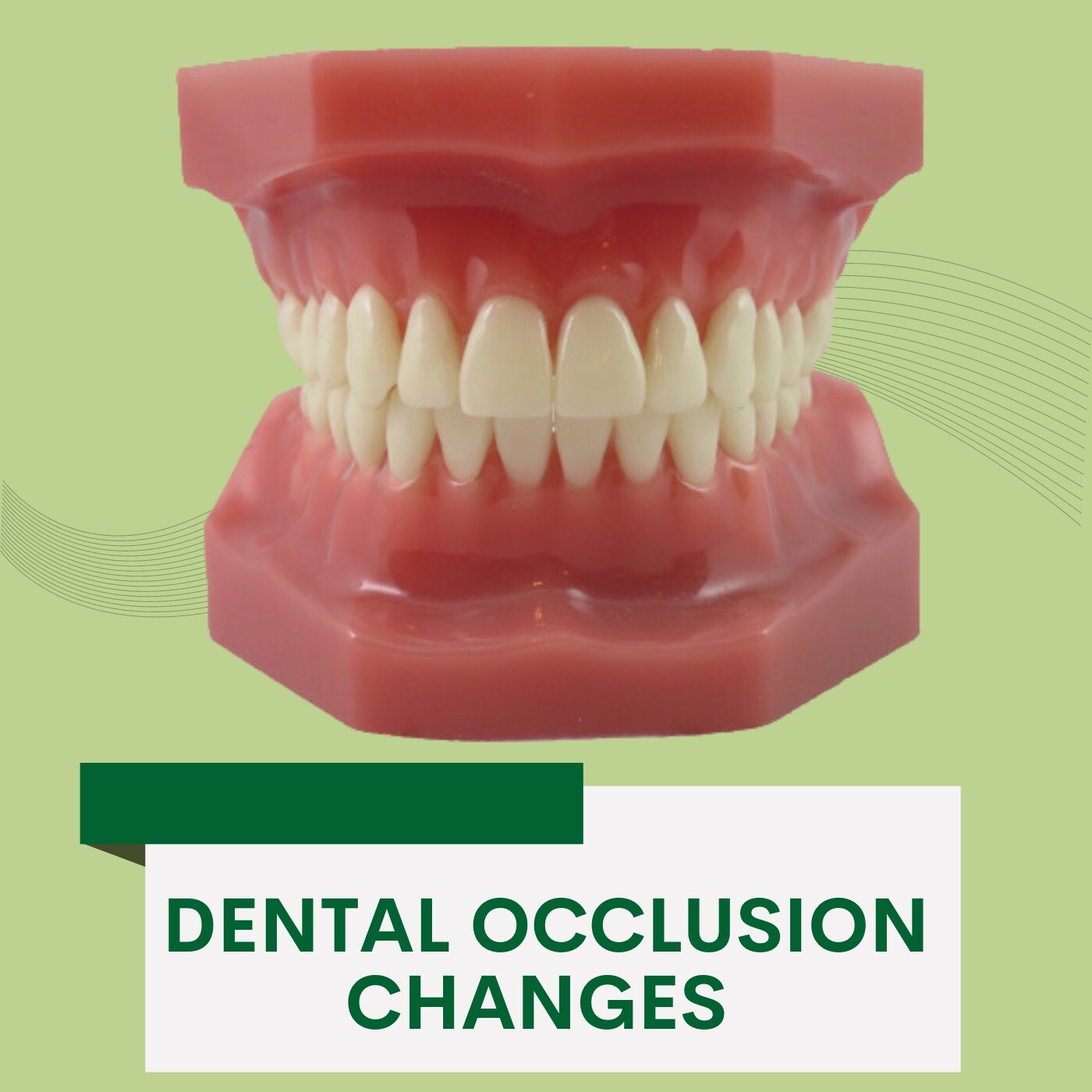 Dental Occlusion Changes, Rearranging Teeth Surgery, Varachha, Dindoli, Dang, surat, Gujarat. episode artwork