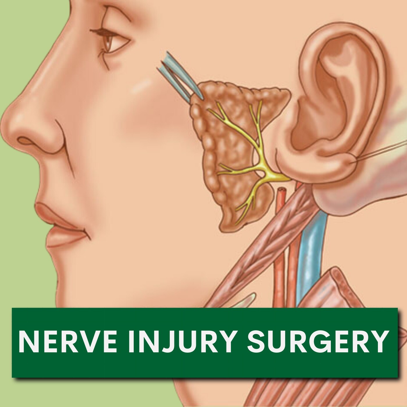 Nerve Injury Surgery, Muscle Relaxtion By Botox, Facial Treatment, Katargam, Bhatar, Palanpur, Surat, Gujarat. episode artwork