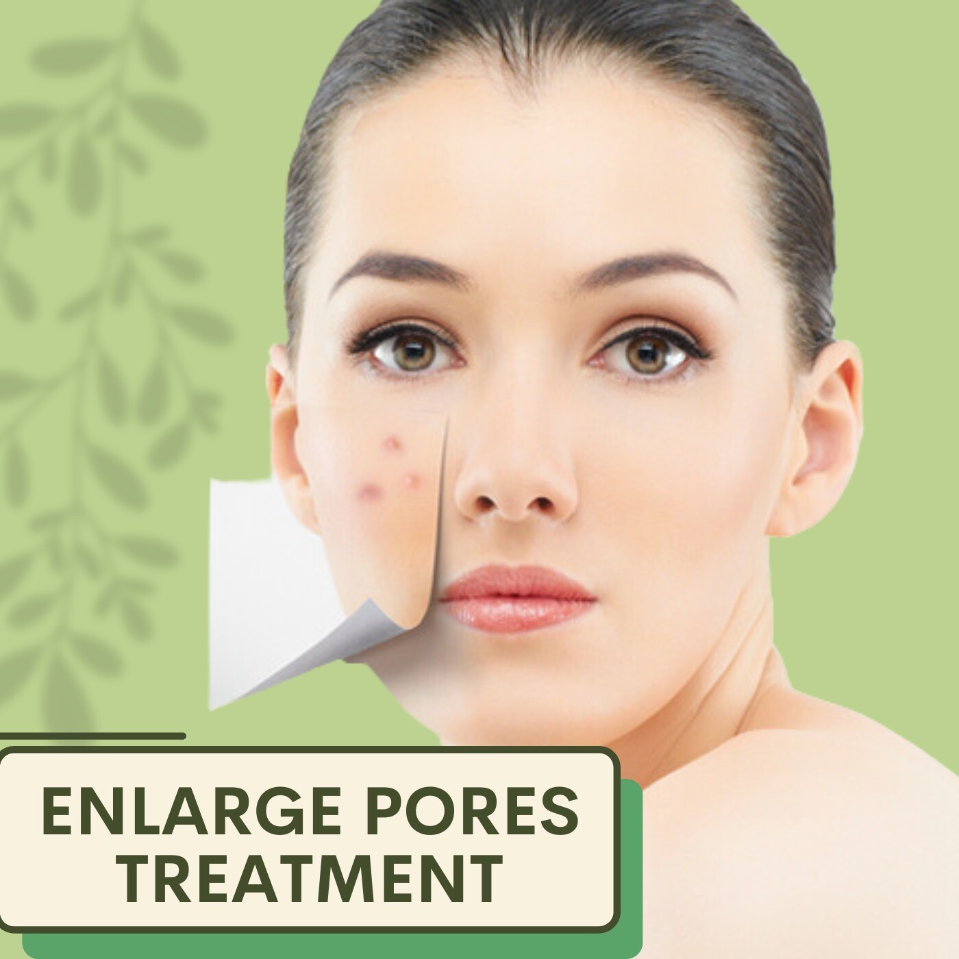 Enlarge Pores Treatment, Enlarged Pore, Microneedling, Palanpor, Nanpura, Rander, Surat, Gujarat. episode artwork