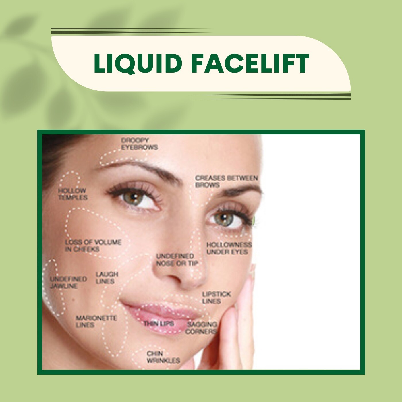 Liquid Facelift, Botox Filler, Replace Volume, Adajan, Pal, Athwa, Surat, Gujarat.