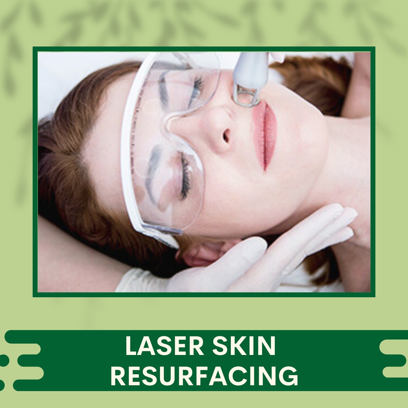 Laser Skin Resurfacing, Reduces Wrinkles, Removes Skin Layer, Majuragate, Jahangirpura, Piplod, Surat, Gujarat.