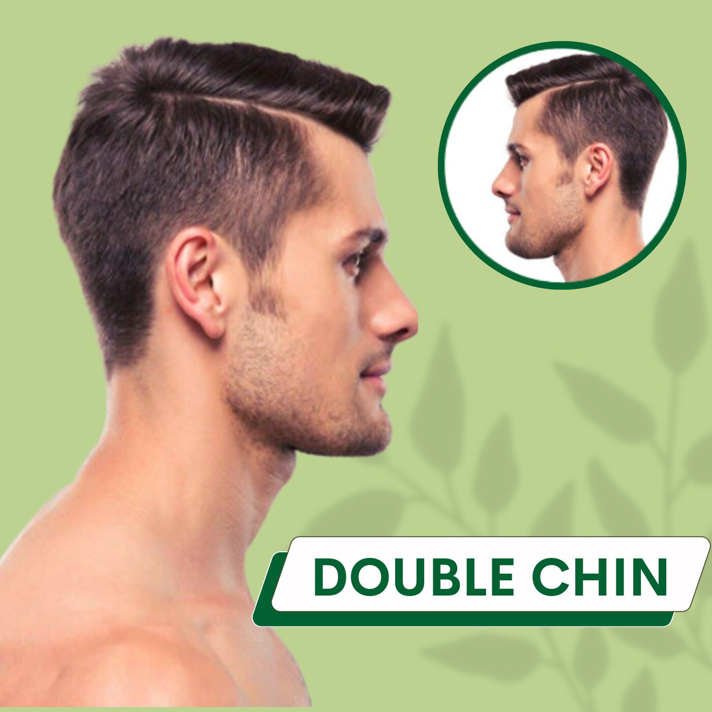 Double Chin, Liposuction, Chin Filler, Neck Lift, Udhna, Athwa, Piplod, Surat, Gujarat. episode artwork