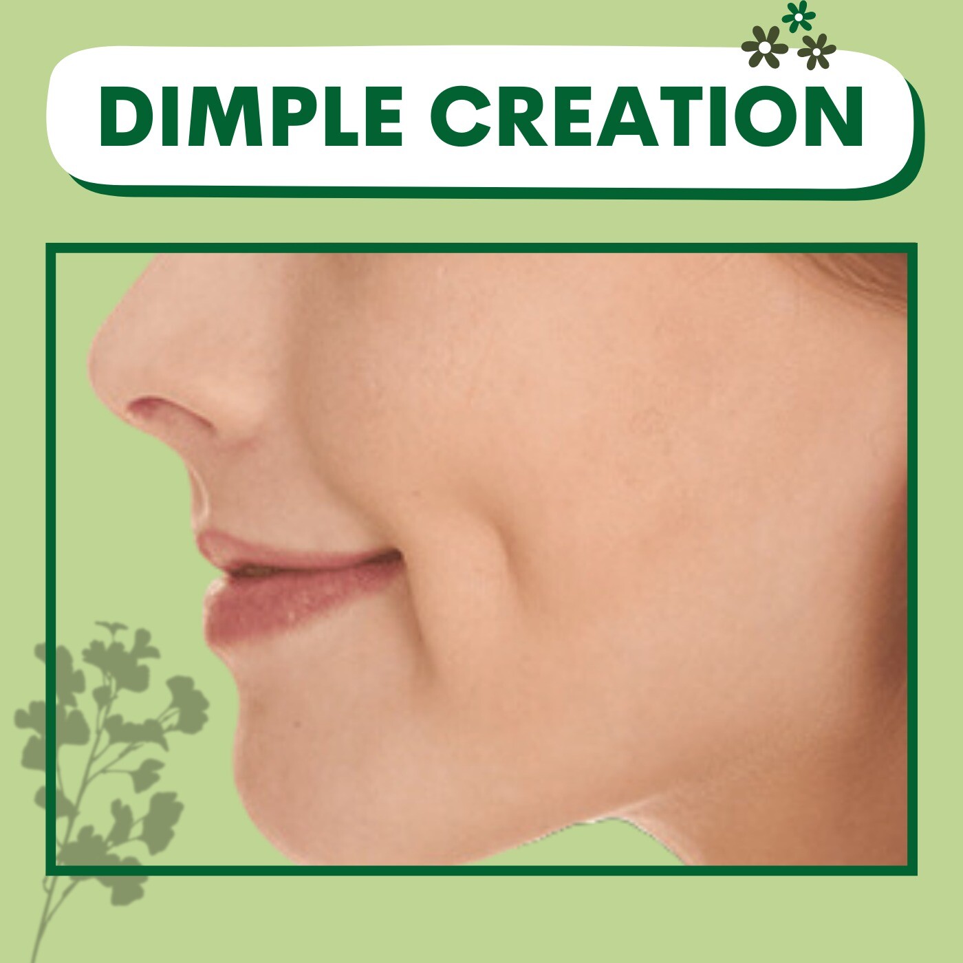 Dimple Creation, Unilateral, Bilateral, Dimple Creation Surgery, Athwa, Piplod, Ghoddhod, Surat, Gujarat.