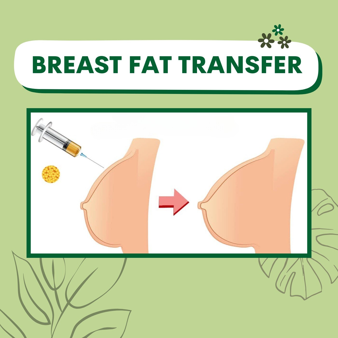 Breast Fat Transfer, Scar Less Result, Breast Augmentation, Surat, Mumbai, Udaipur, India. episode artwork