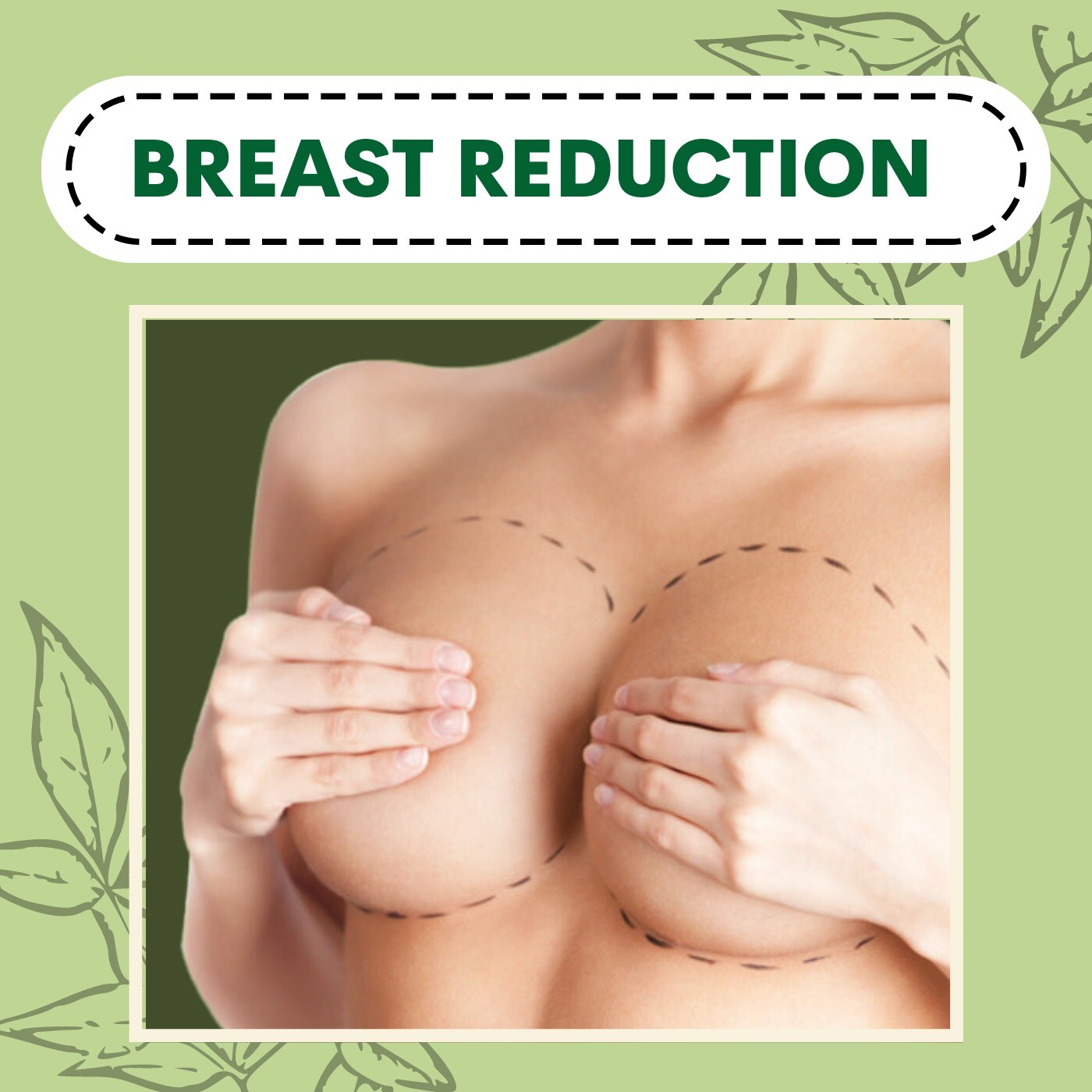 Breast Reduction (Mammoplasty), Removes Fat, Reduce Overall Breast Volume, Katargam, Piplod, Rander, Surat, Gujarat. episode artwork