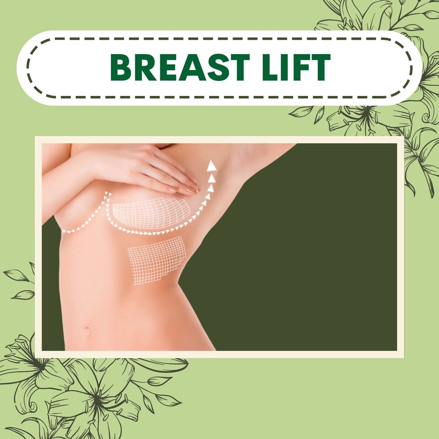 Elegance Clinic Surat Dr. Ashutosh Shah