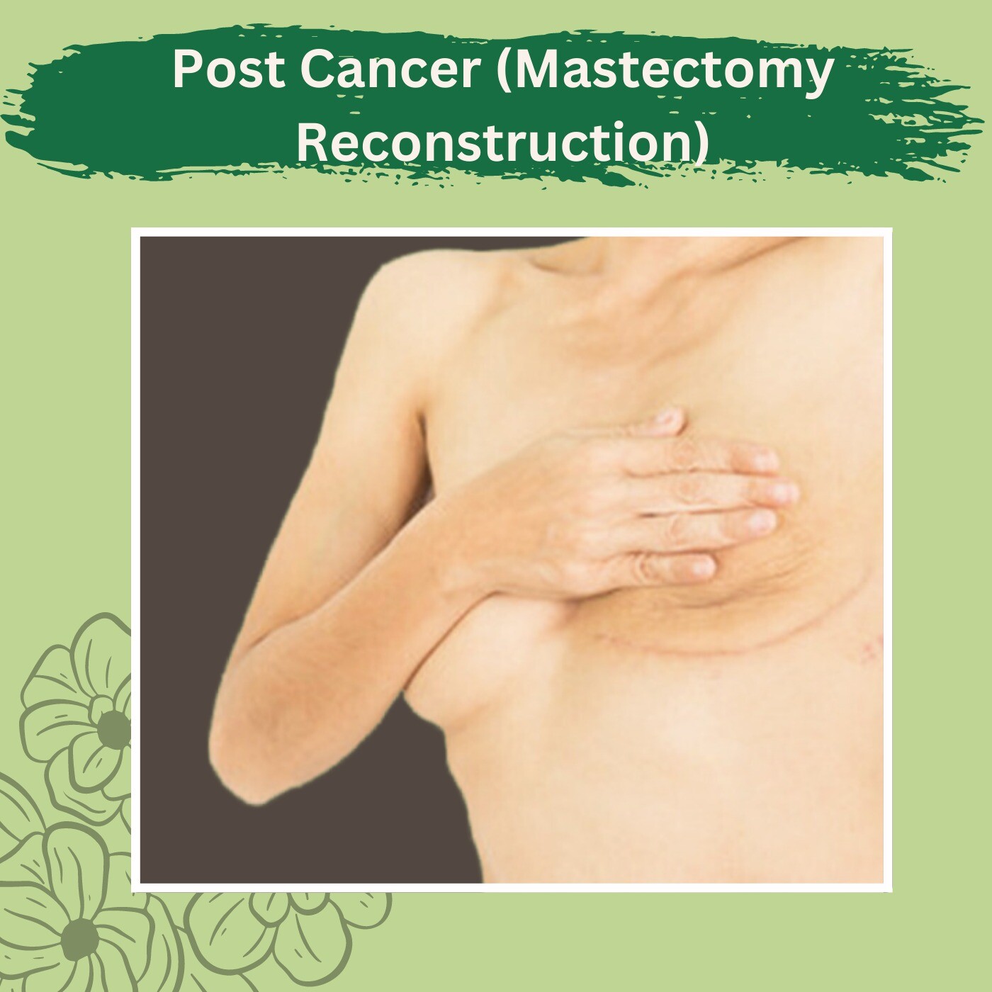 Post Cancer (Mastectomy Reconstruction), Rebuild the shape, Reconstruction Surgery, Surat, Ahmedabad, Rajkot, Gujarat, India. episode artwork