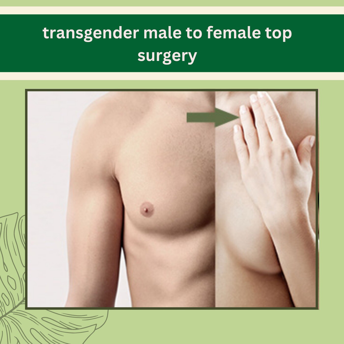 Transgender Male To Female Top Surgery, Breast Implant, Chest Surgery, Hormonal therapy, Udhna, Bhatar, Piplod, Surat, Gujarat. episode artwork