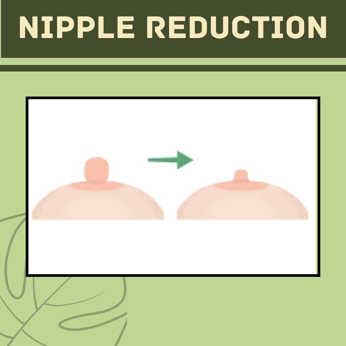 Nipple Reduction Surgery, Removes Extra Skin in Nipple, Cost, Ahmedabad, Pune, Surat, Indore, India.