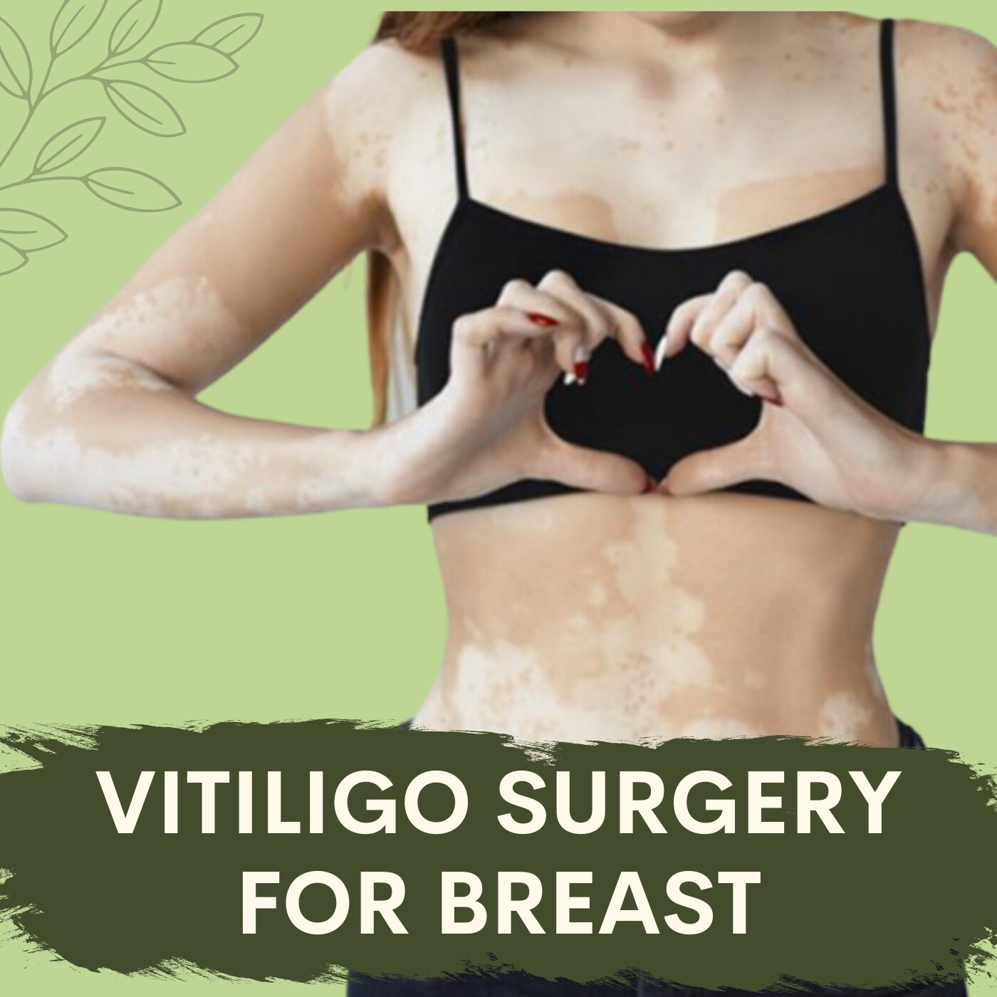 Vitiligo Surgery For Breast, Nipple Areola, Surgical Removal Treatment, Dindoli, Pandesara, Udhna, Bhatar, Surat, Gujarat. episode artwork