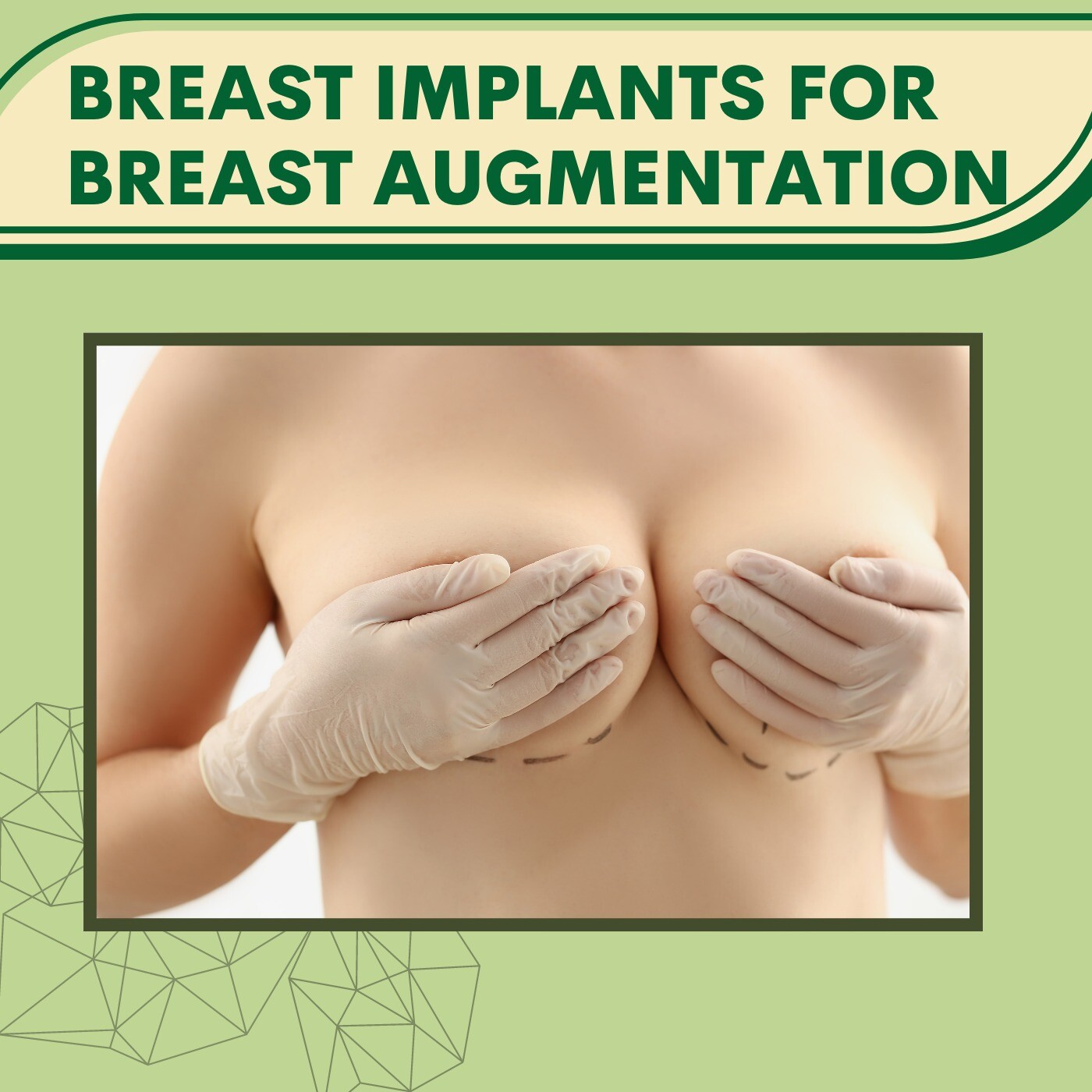 Breast Implants For Breast Augmentation, Silicon Implant Treatment, Increase Breast Volume, Mirzapur, Satara, Surat, India. episode artwork