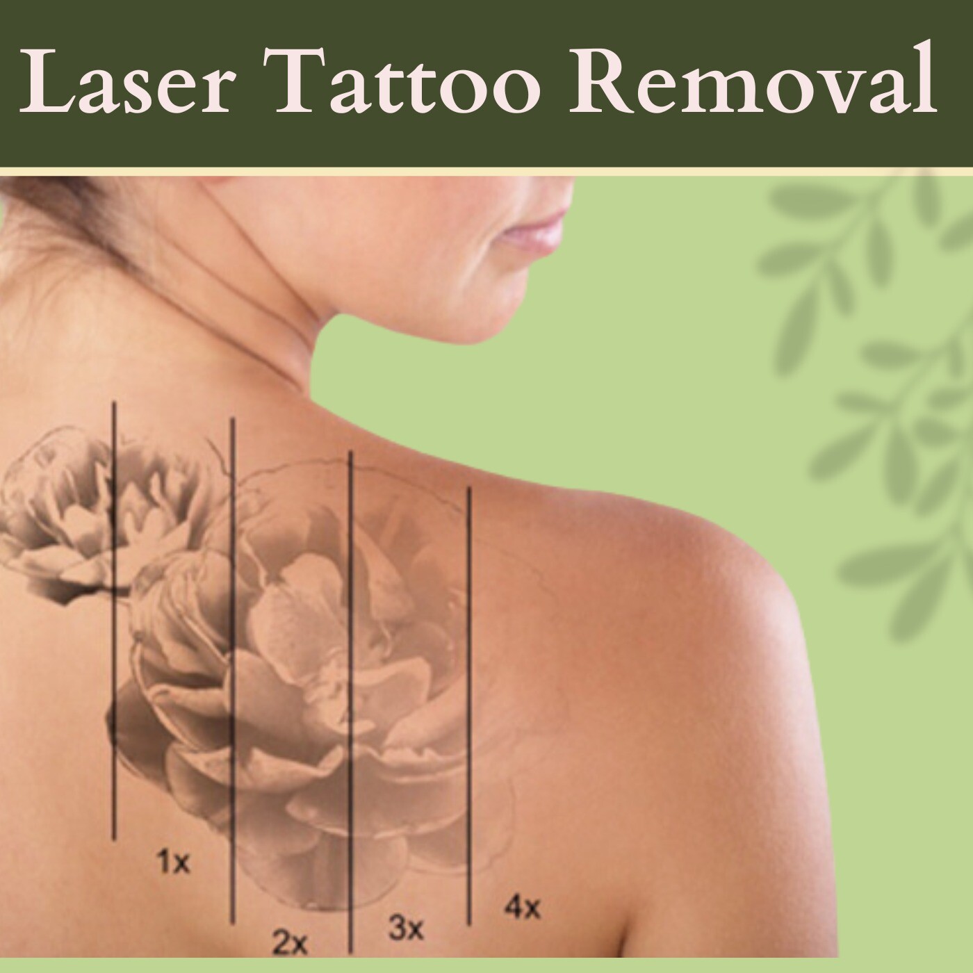 Laser Tattoo Removal, Remove Permanent Ink, Microplastics Removal, Dhule, Udaipur, Surat, India. episode artwork