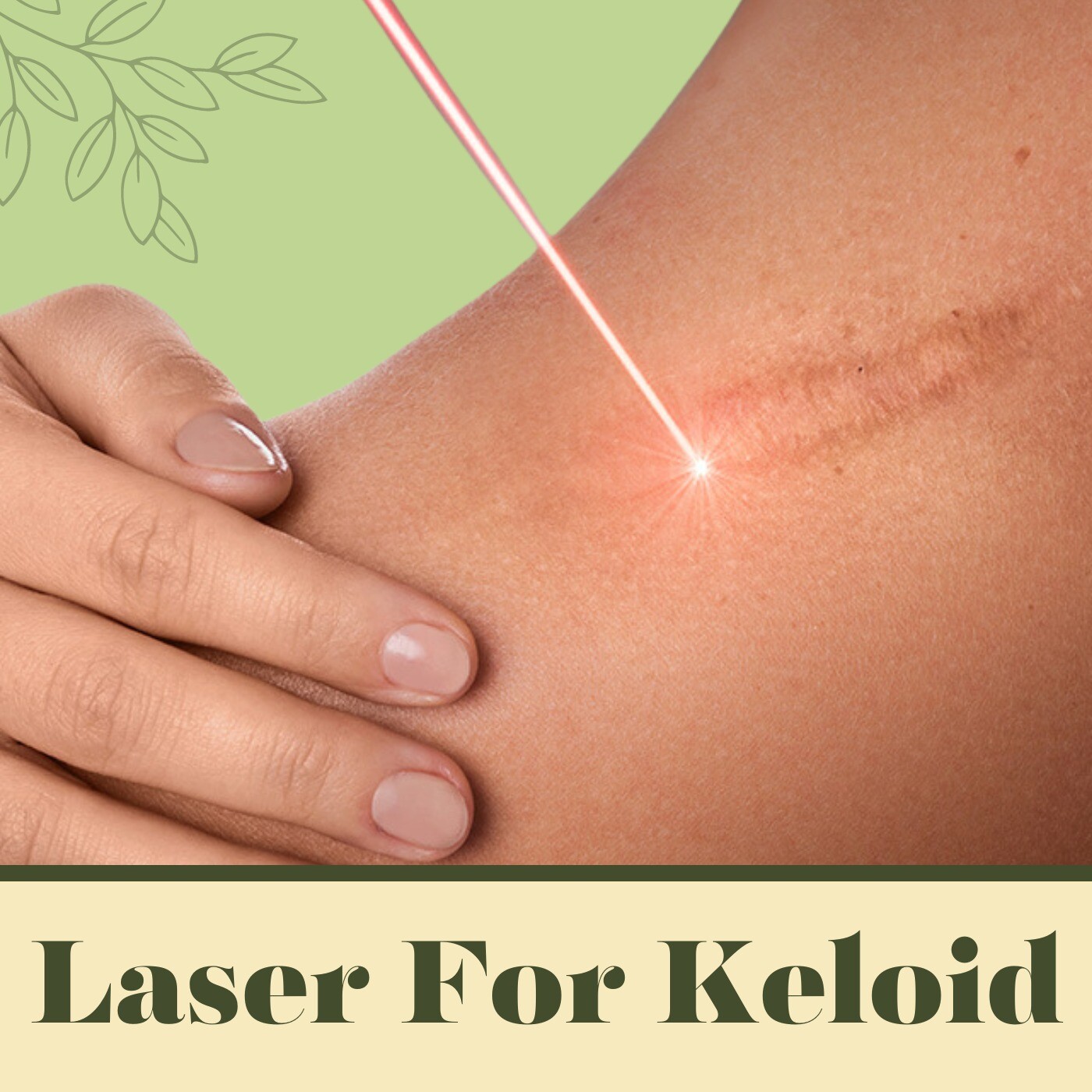 Laser For Keloid, Keloid Scar Reduction, Hypertrophic Scars, Himatnagar, Ambikapur, Nanded, Surat, India. episode artwork