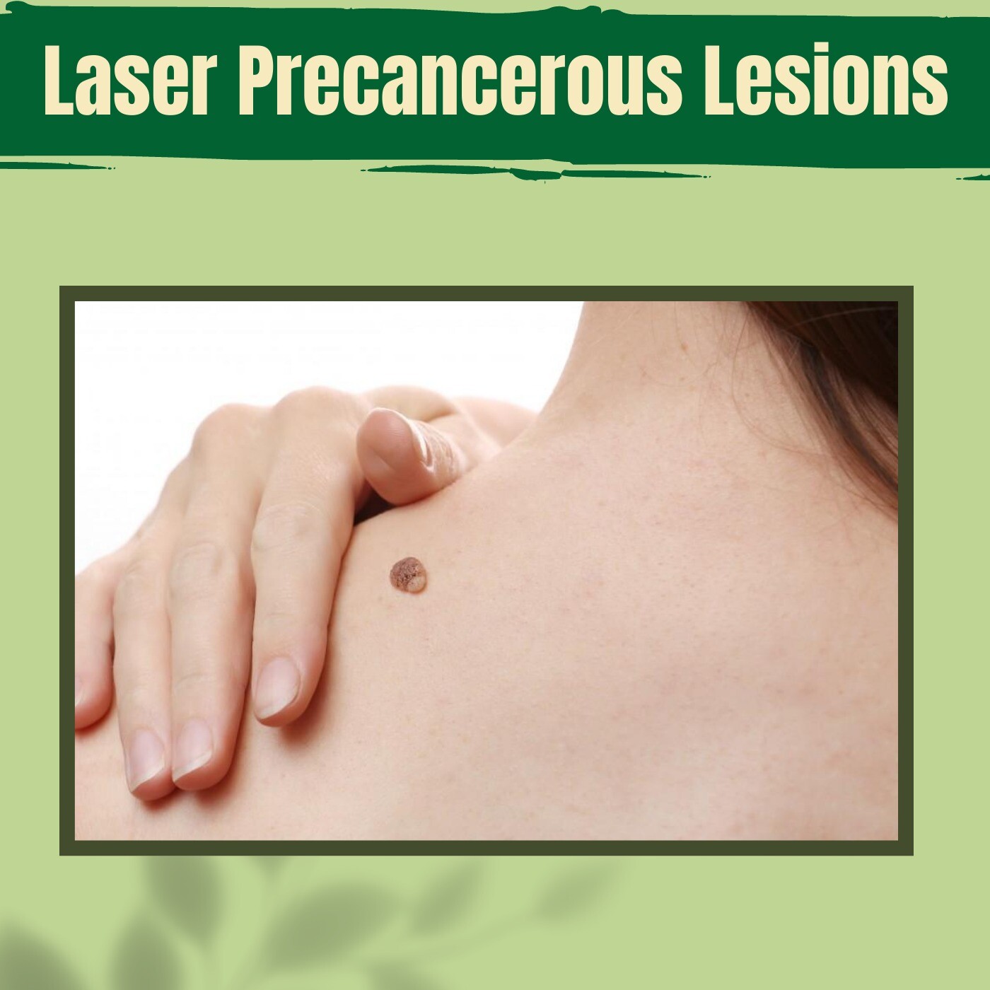 Laser Precancerous Lesions, Remove Pre-cancerous Growths, Skin Graft, Ambikapur, Nagpur, Kanpur, Surat, India.