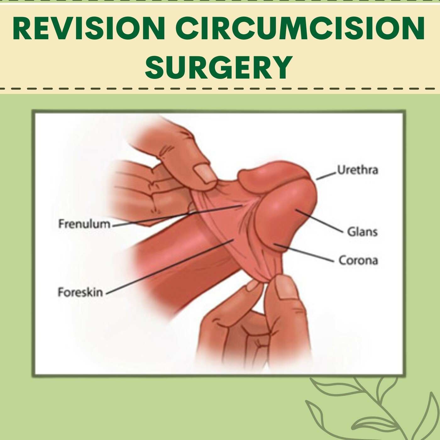 Revision Circumcision Surgery, Indications , Skin Air Treatment, Bhachau, Indore, Amravati, Surat, India. episode artwork
