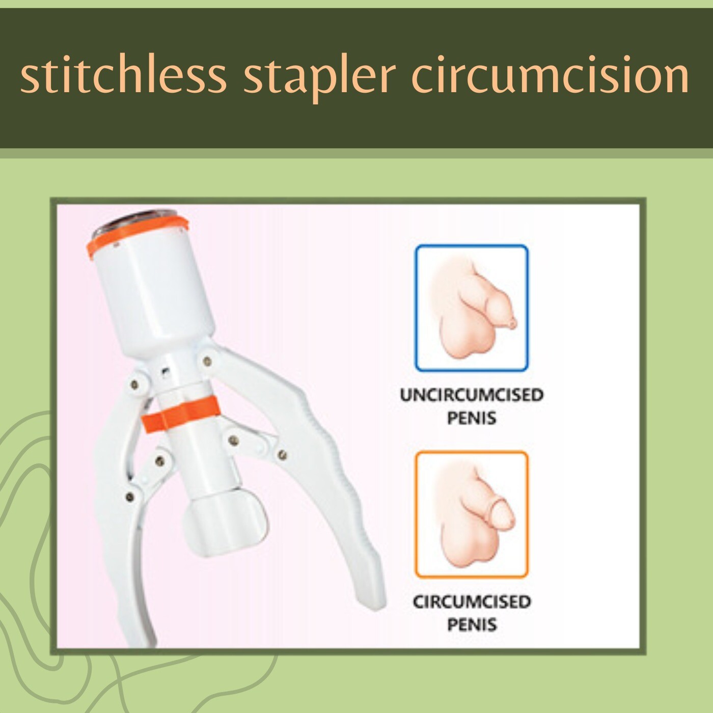 Stitchless Stapler Circumcision, Minimally invasive, Quick procedure, Mundra, Ajmer, Satara, Surat, India. episode artwork