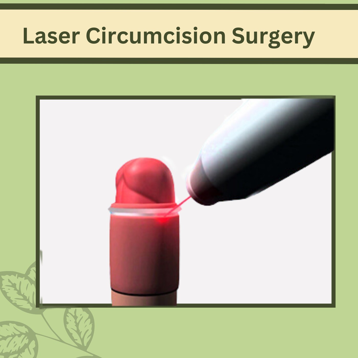 Laser Circumcision Surgery, CO2 Laser, Allis Clamp Procedure, Mehsana, Patna, Mumbai, Surat, India.