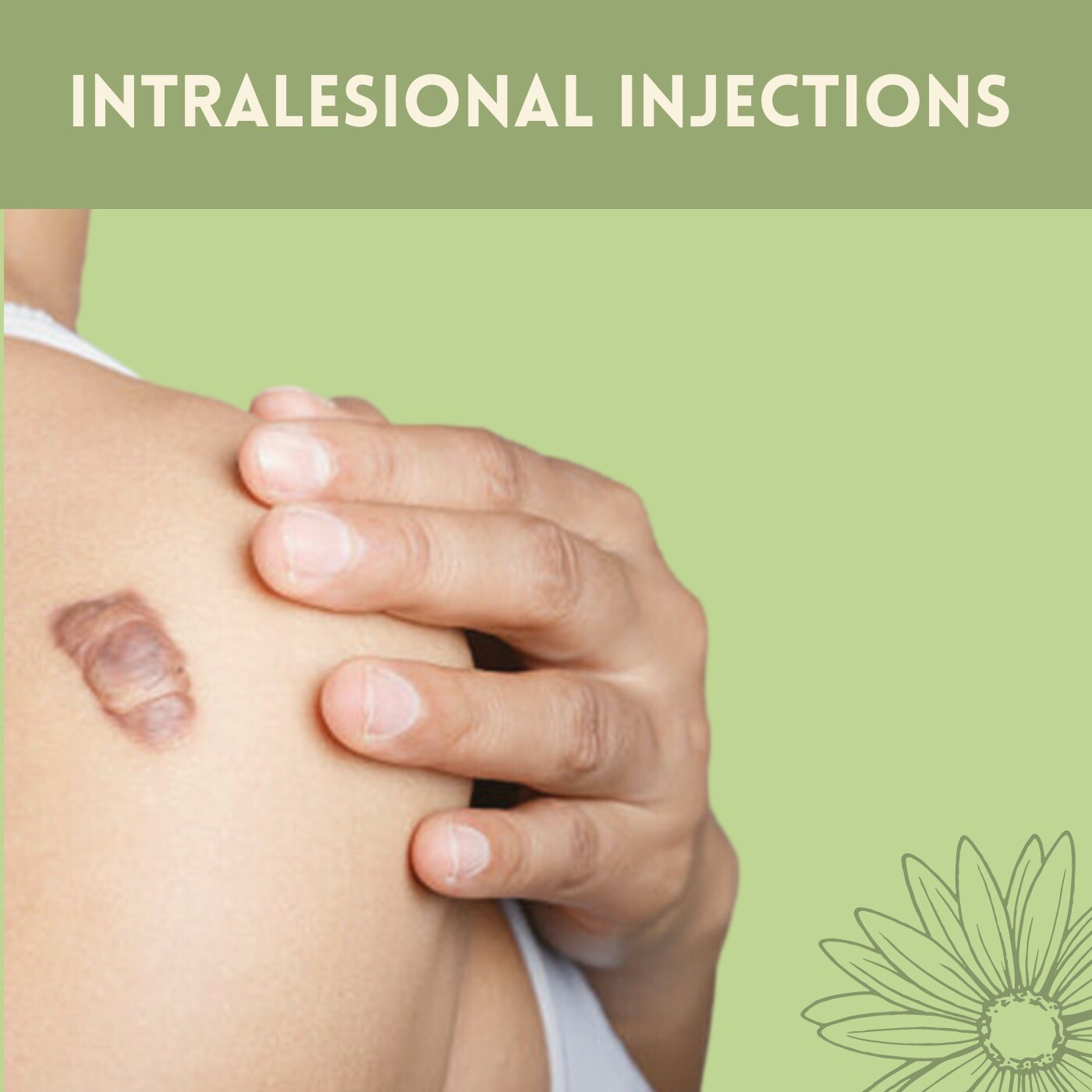 Intralesional Injections, Dermatological Treatment, Reduce Keloid Size, Ranchi, Udaipur, Jamnagar, Surat, India. episode artwork