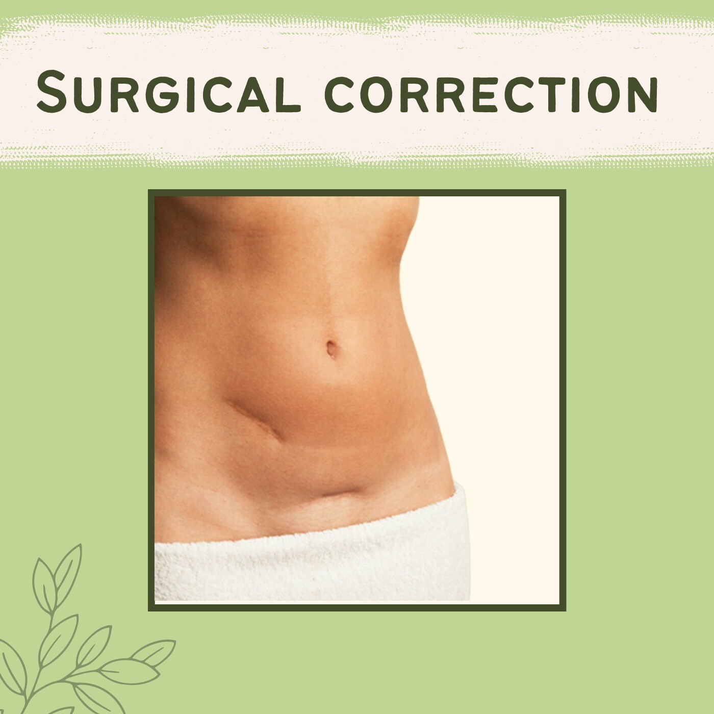 Surgical Correction, Pressure Garments Therapy, Excision Surgery, Gandhidham, Prayagraj, Ahmednagar, Surat, India. episode artwork