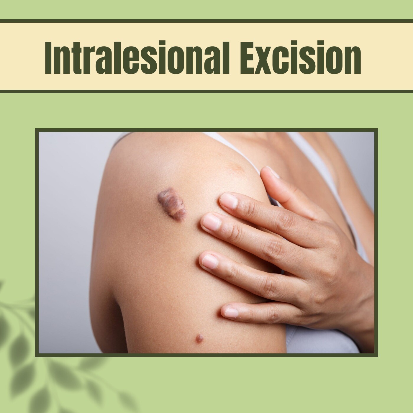 Intralesional Excision, Surgical Scar Removal, Keloid Prevention Treatment, Mundra, Patna, Aurangabad, Surat, India. episode artwork