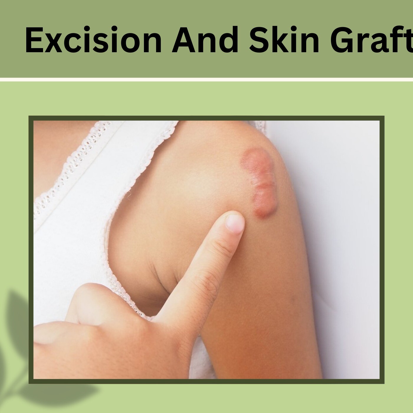 Excision and Skin Graft, Keloid recurrence, Primary Closure Procedure, Bhavnagar, Nashik, Surat, India. episode artwork