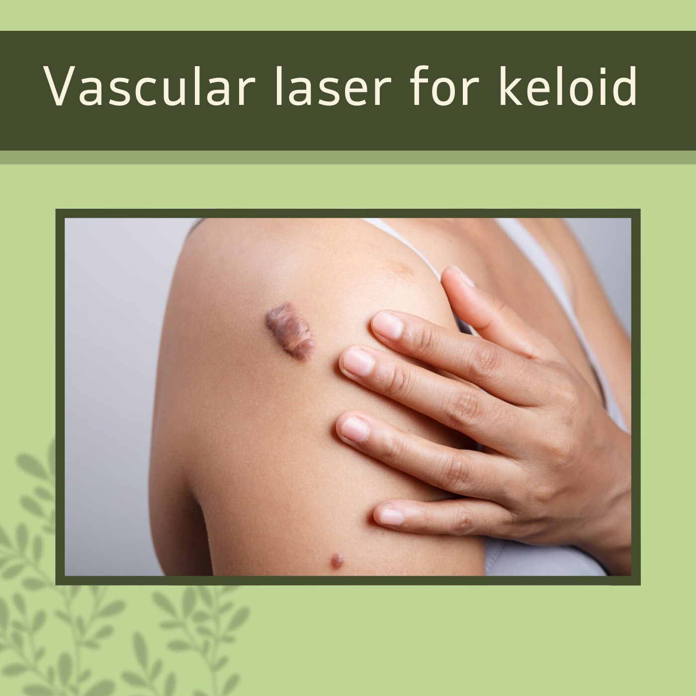 Vascular Laser For Keloid, CO2 Laser, Reduce Blood Vessel Coagulation, Jamnagar, Jalna, Surat, India.