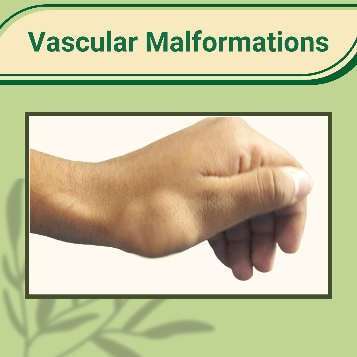 Vascular Malformations, Radiological Imaging, Hemangioma, Bhachau, Bhilwara, Solapur, Surat, India.